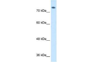 WB Suggested Anti-ABP1 Antibody  Titration: 1 ug/ml Positive Control: HepG2 cell lysate (DAO anticorps  (C-Term))