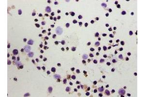 Immunohistochemistry of paraffin-embedded Hela cells using ABIN7153097 at dilution of 1:100 (FOXP3 anticorps  (AA 1-260))