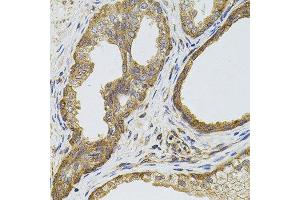 Immunohistochemistry of paraffin-embedded human prostate using EGFR antibody. (EGFR anticorps  (AA 1021-1210))