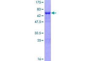 Image no. 1 for Suppressor of Defective Silencing 3 Homolog (SUDS3) (AA 1-328) protein (GST tag) (ABIN1321846)
