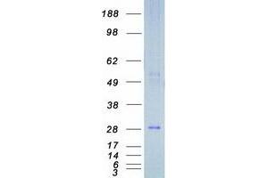 Validation with Western Blot