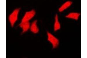 Immunofluorescent analysis of CSN1 staining in SKOV3 cells. (GPS1 anticorps)