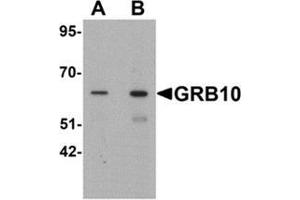 Western blot analysis of GRB10 in SK-N-SH cell lysate with GRB10 Antibody  at (A) 1 and (B) 2 µg/ml.