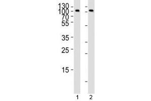 Western blot analysis of lysate from 1) Raji and 2) Ramos cell line using anti-CD19 antibody at 1:1000.
