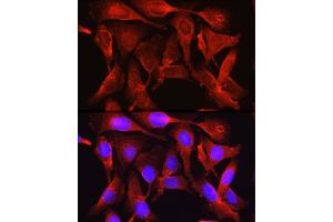 Immunofluorescence analysis of U2OS cells using Proprotein Convertase 9(PCSK9) Rabbit pAb (ABIN6133851, ABIN6145328, ABIN6145330 and ABIN6223837) at dilution of 1:250 (40x lens).