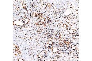 IHC analysis of EML4 using anti-EML4 antibody (ABIN6719384). (EML4 anticorps  (AA 207-423))