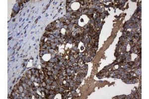 Image no. 4 for anti-NADH Dehydrogenase (Ubiquinone) 1 beta Subcomplex, 10, 22kDa (NDUFB10) antibody (ABIN1499672) (NDUFB10 anticorps)