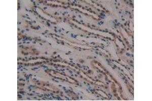 IHC-P analysis of Human Kidney Tissue, with DAB staining. (GDF3 anticorps  (AA 251-364))