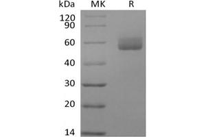 Western Blotting (WB) image for Glycosylphosphatidylinositol Anchored High Density Lipoprotein Binding Protein 1 (GPIHBP1) protein (Fc Tag) (ABIN7319833)
