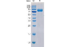 Human CD19 Protein, hFc-His Tag on SDS-PAGE under reducing condition.
