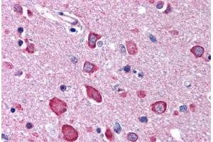 Brain, cortex (BRSK1 anticorps  (C-Term))