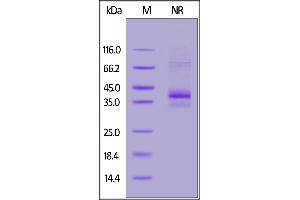 Human CCR5, Flag,His Tag on  under ing (NR) condition. (CCR5 Protein (AA 2-223, AA 227-319) (His tag,DYKDDDDK Tag))