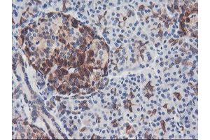 Image no. 11 for anti-phosphofructokinase, Platelet (PFKP) antibody (ABIN1500164)