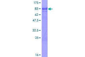 Image no. 1 for IKAROS Family Zinc Finger 1 (Ikaros) (IKZF1) (AA 1-477) protein (GST tag) (ABIN1307650)
