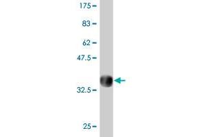 Western Blot detection against Immunogen (31.
