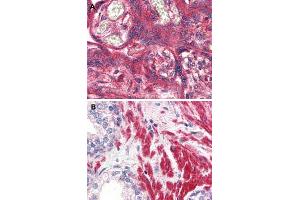 Immunohistochemical (Formalin/PFA-fixed paraffin-embedded sections) staining in human placenta (A) and human prostate (B) with OR51E1 polyclonal antibody . (OR51E1 anticorps  (Internal Region))