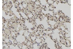 ABIN6279694 at 1/100 staining Rat lung tissue by IHC-P. (PPP1R2P3 anticorps)