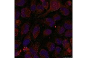 Immunofluorescence staining of methanol-fixed Hela cells using GATA1(Phospho-Ser142) Antibody. (GATA1 anticorps  (pSer142))