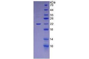 SDS-PAGE analysis of Mouse Laminin alpha 1 Protein. (Laminin alpha 1 Protéine)