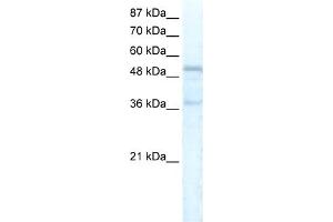 WB Suggested Anti-FOXC1 Antibody Titration:  5. (FOXC1 anticorps  (C-Term))