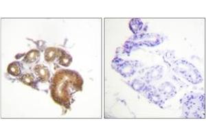 Immunohistochemistry analysis of paraffin-embedded human skin tissue, using ETK (Ab-40) Antibody. (BMX anticorps  (AA 6-55))