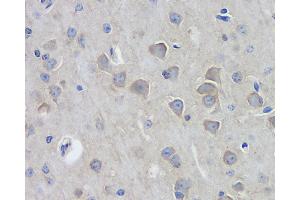Immunohistochemistry analysis of paraffin-embedded mouse brain using DLG4 Polyclonal Antibody at dilution of 1:100. (DLG4 anticorps)
