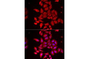 Immunofluorescence analysis of U2OS cells using TMOD4 antibody. (Tropomodulin 4 anticorps)