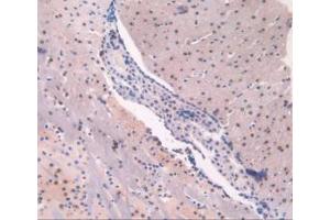 IHC-P analysis of Mouse Brain Tissue, with DAB staining. (ADK anticorps  (AA 1-361))
