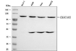 Western blot analysis of CEACAM1 using anti-CEACAM1 antibody (ABIN7601244).