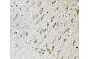 Immunohistochemistry of paraffin-embedded Rat brain using MT-ND5 Polyclonal Antibody at dilution of 1:100 (40x lens). (MT-ND5 anticorps)
