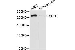 Western blot analysis of extracts of various cell lines, using SPTB antibody (ABIN6290966) at 1:3000 dilution. (Spectrin beta Chain, Erythrocyte (SPTB) anticorps)