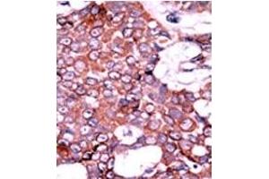Image no. 2 for anti-Cell Division Cycle 25 Homolog A (S. Pombe) (CDC25A) (pSer76) antibody (ABIN358097) (CDC25A anticorps  (pSer76))