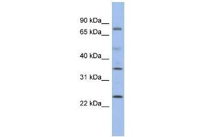 WB Suggested Anti-PPM1K Antibody Titration: 0. (PPM1K anticorps  (Middle Region))