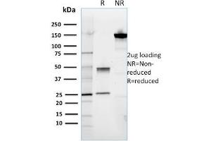 anti-Receptor Tyrosine Kinase-Like Orphan Receptor 2 (ROR2) antibody