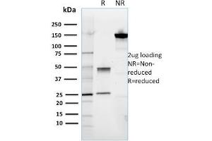 SDS-PAGE Analysis Purified ROR2 Mouse Monoclonal Antibody (ROR2/1911).