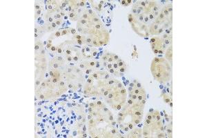 Immunohistochemistry of paraffin-embedded mouse kidney using SET antibody at dilution of 1:100 (x40 lens).