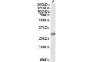 E3 Ubiquitin-Protein Ligase SIAH1 (SIAH1) peptide