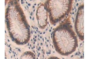 Detection of OIT3 in Human Stomach Tissue using Polyclonal Antibody to Oncoprotein Induced Transcript 3 (OIT3)