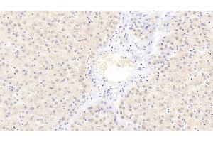 Detection of C3a in Human Liver Tissue using Polyclonal Antibody to Complement Component 3a (C3a)