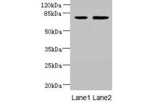 Western blot All lanes: ARMC9 antibody at 6 μg/mL Lane 1: Jurkat whole cell lysate Lane 2: CEM whole cell lysate Secondary Goat polyclonal to rabbit IgG at 1/10000 dilution Predicted band size: 92, 76 kDa Observed band size: 76 kDa (ARMC9 anticorps  (AA 401-665))