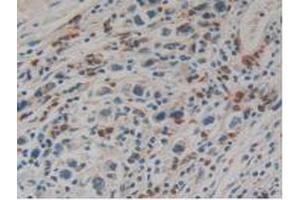 Figure. (Kallikrein 10 anticorps  (AA 35-276))