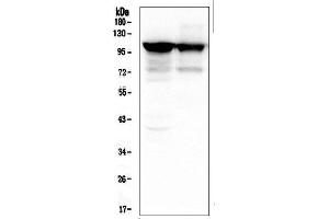Western blot analysis of ACTN3 using anti-ACTN3 antibody (ABIN6719273).