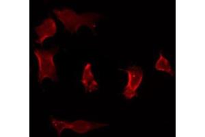 ABIN6275919 staining Hela by IF/ICC. (CCR7 anticorps  (Internal Region))