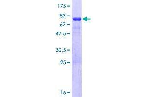 Image no. 1 for WW Domain Containing E3 Ubiquitin Protein Ligase 2 (WWP2) (AA 1-335) protein (GST tag) (ABIN1325407)