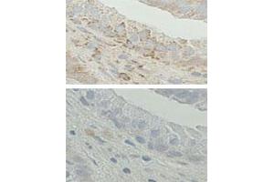 Immunohistochemistry on Formalin-fixed and paraffin-embedded human prostate tissue.