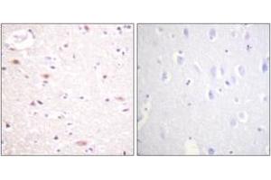 Immunohistochemistry analysis of paraffin-embedded human brain, using CDC16/APC6 (Phospho-Ser560) Antibody. (CDC16 anticorps  (pSer560))