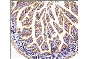 IHC analysis of CDC42 using anti-CDC42 antibody (ABIN6719528).