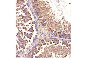 Immunohistochemistry of paraffin embedded rat testis using p1d1 (ABIN7075069) at dilution of 1:2000 (400x lens)