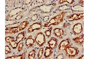 Immunohistochemistry of paraffin-embedded human kidney tissue using ABIN7156336 at dilution of 1:100 (IRS2 anticorps  (AA 766-1001))