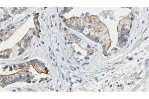 ABIN6272608 at 1/100 staining Human prostate tissue by IHC-P. (NPR1 anticorps  (Internal Region))